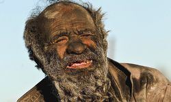 İran’da 70 yıldır yıkanmayan adam yıkandıktan sonra öldü
