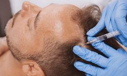 Saç dökülmesine karşı yeni önlem: PRP nedir, nasıl uygulanır?