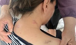 17 bıçak darbesi aldı, ölü numarasıyla kurtuldu, kocasının en ağır cezayı almasını istedi