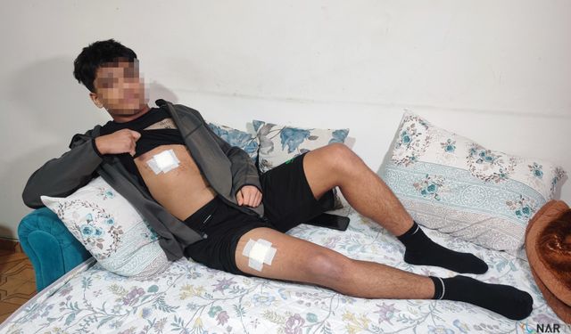 Akran zorbalığı az kalsın öldürüyordu.