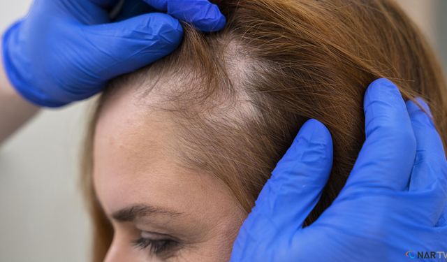 Kadınlarda saç dökülmesinin gizli nedenleri.