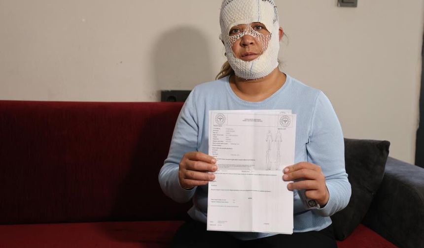 Güzelleşmek uğruna gittiği merkezde yüzü yandı