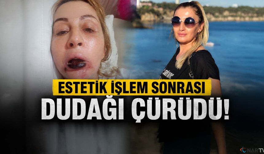 7 Yıldır hukuk mücadelesi veriyor.